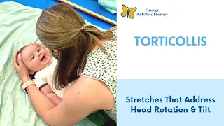 Torticollis: 2 Stretches To Try At Home