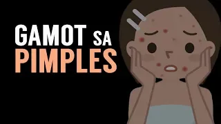 GAMOT SA PIMPLES - Payo ni Dra. Katty Go (Dermatologist) #4b