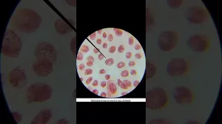 Mitosis in onion root tip || #neet  #biochemical #laboratory #biology #microscope #cell