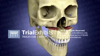 Surgical Advancements of the Maxilla and Mandible