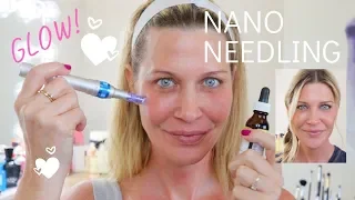 ☀️Nano Needling | How to needle at home for SERIOUS glow!!