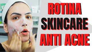 COMO FAZER UMA ROTINA SKINCARE ANTI ACNE - DIURNA PASSO A PASSO