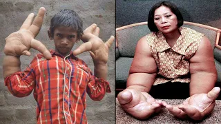 Unusual People With Extraordinary Body Parts