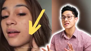 ANG TOTOONG DAHILAN NG LOCK-JAW NI ZEINAB