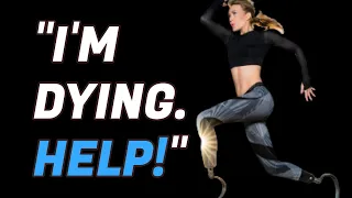 YOU CAN DO AND BE ANYTHING YOU WANT | Amy Purdy Motivational Speech