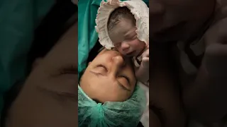 Baby First Cry After Birth || Mother Love || #shorts
