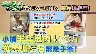 小禎半年甩肉40公斤 年初膽結石緊急手術! 健康2.0