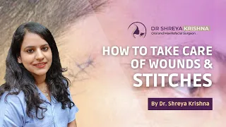 How To Care For Face Wounds and Stitches | Face Stitches Healing & Removal Time | Stitches Aftercare