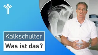 Kalkschulter einfach erklärt: So entstehen Schulterschmerzen durch die Kalkschulter