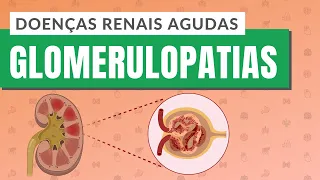 DOENÇAS RENAIS AGUDAS | PARTE 1: Glomerulopatias