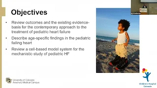 Does the Shoe Fit? Adult Guideline Directed Medical Therapy and the Failing Pediatric Heart