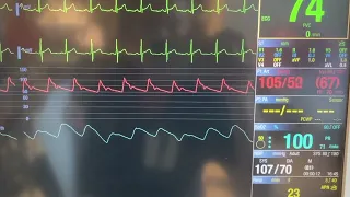 ICU Bedside Monitor Tutorial