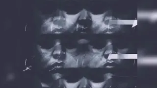 Eädyth- Lazarus (David Bowie Cover)