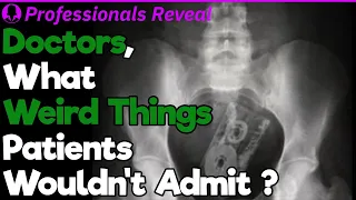 Doctors, What Is the Weirdest Thing a Patient Wouldn't Admit? | Professionals' Stories #6