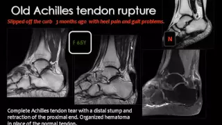 Imaging of the Ankle joint  DRE 5   Dr Mamdouh Mahfouz 720p