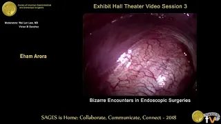 Bizarre encounters in endoscopic surgery