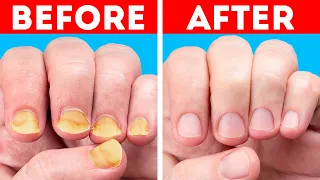 Stunning Manicure Ideas And Nail Hacks That You Will Adore