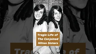 The Sad Story Of The Conjoined Hilton Sisters #shorts #unknownfacts