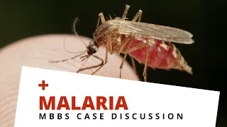 MBBS Case Discussion || Malaria