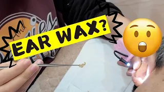 Watch as a Korean Dad's Ear Wax is Completely Removed in China!