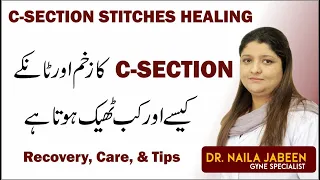 C Section Delivery Internal Stitches Wound Healing | Care Recovery & Tips | Tanky Kesy Theek Kren Gy