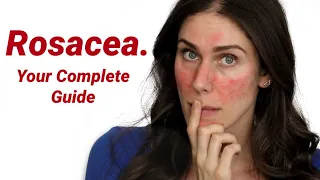 Why Does Everyone Get Rosacea Wrong? What It Is and How to Treat It
