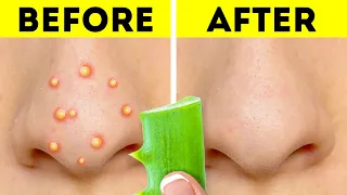 Skincare Hacks You Should Know || Natural Beauty Tips