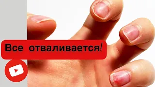 УКРЕПЛЕНИЕ коротких НОГТЕЙ | ГЕЛЕВОЕ покрытие.