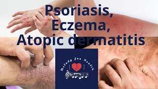 Psoriasis. Eczema. Atopic dermatitis.  Music therapy.  Recommendations