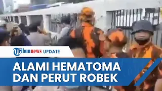 Kondisi Terkini Perwira Polisi yang Dikeroyok Ormas Pemuda Pancasila, Alami Hematoma dan Perut Robek