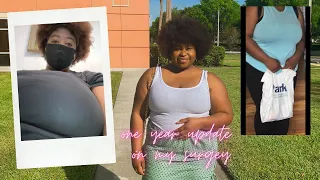 ONE YEAR UPDATE ON MY BREAST REDUCTION---TAKING LEGAL ACTION, REGRET, AND SHAME