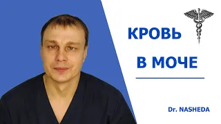 КРОВЬ В МОЧЕ  (ГЕМАТУРИЯ)