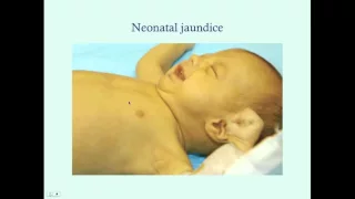 Introduction to Newborn Jaundice - CRASH! Medical Review Series