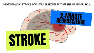 2-Minute Neuroscience: Stroke