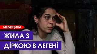 🙏Вирізали П'ЯТЬ РЕБЕР і пів легені! Неправильний діагноз мало не коштував жінці життя