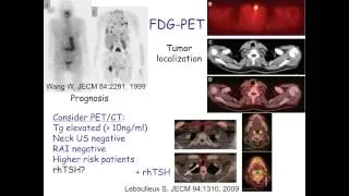 Thyrogen used in connection with testing and treatment of differentiated thyroid cancer