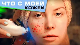 ЧТО НЕ ТАК С МОЕЙ КОЖЕЙ? // Консультация косметолога + алмазная микродермабразия дома