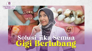 SOLUSI JIKA SEMUA GIGIMU BERLUBANG