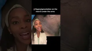 How to get rid of hyperpigmentation on the neck and under the arms