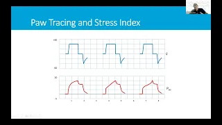 Understanding Mechanical Ventilator Scalars and Loops