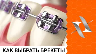 Как выбрать БРЕКЕТЫ и не прогадать? (Осознанный выбор)