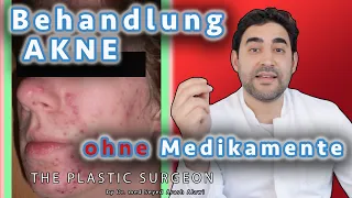 Wie man AKNE ohne Medikamente behandelt! | Dr. Alawi