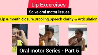 oral motor lip exercise/lip & mouth closure, drooling,speech clarity & articulation/oromotor part 5