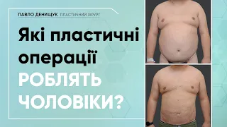 ПЛАСТИЧНІ ОПЕРАЦІЇ ДЛЯ ЧОЛОВІКІВ