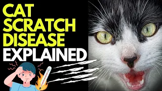 Doctor explains CAT SCRATCH FEVER disease | Causes, symptoms and treatment