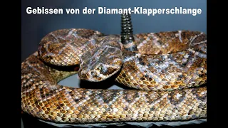 Erfahrungsbericht: Gebissen von der Diamant-Klapperschlange | Kurzdoku Schlangenbiss