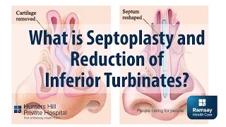 What is Septoplasty and reduction of Inferior Turbinates?