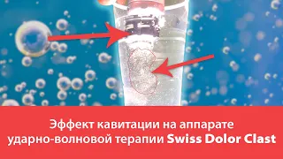 Эффект кавитации на аппарате ударно-волновой терапии Swiss Dolor Clast