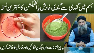 Fungal Infection Treatment | Fungal Infection Ka ilaj | Chambal Bimari Ka ilaj Dr Sharafat Ali Video