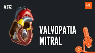 EPISÓDIO 232: Valvopatia Mitral